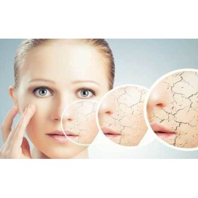 Dry and delicate skin