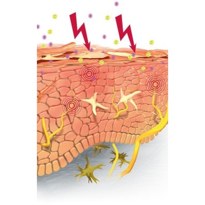 Cute irritata e infiammata