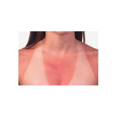 Prevention of photo-induced damage